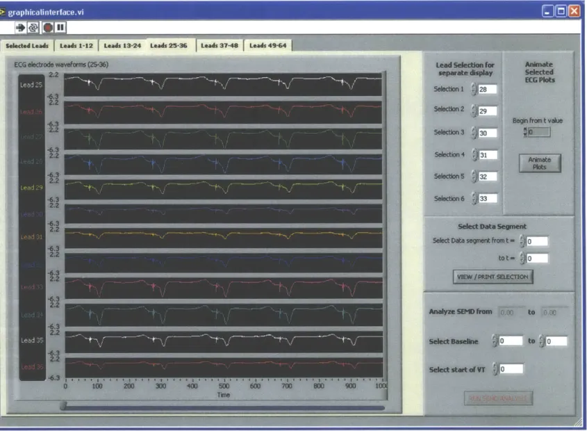 Figure 5.4: Recording and simultaneous display of signal data. Leads 25-36 are shown.