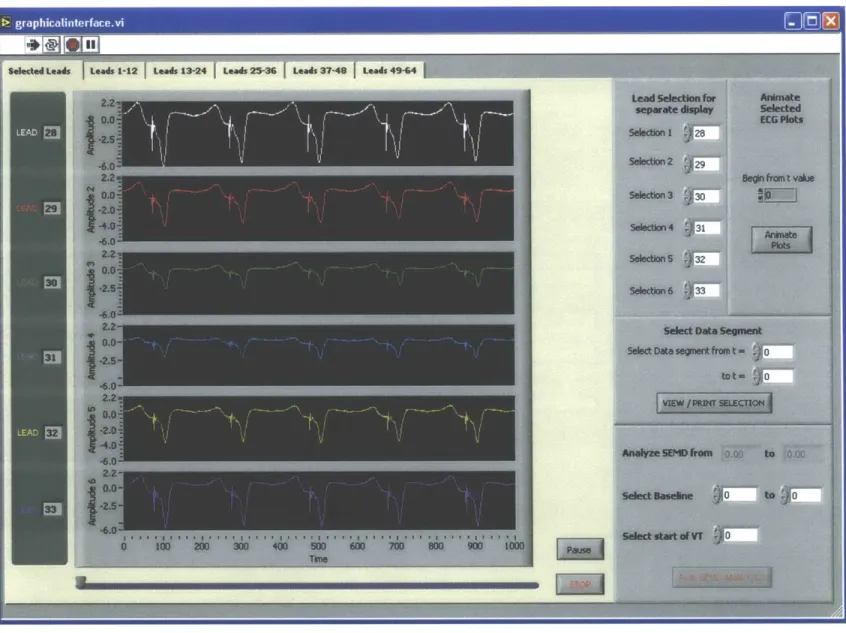 Figure 5.5: Display of selected leads