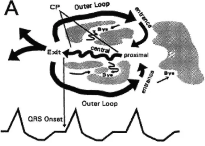 Figure  1.1:  Reentrant Circuit around an infarct scar. From Stevenson at al. [21]