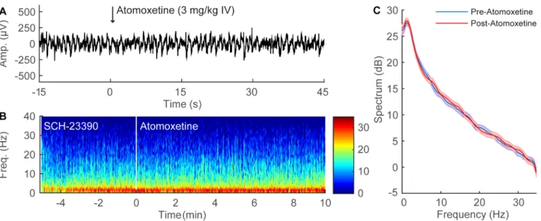 Fig 6. SCH-23390 inhibits the EEG changes induced by atomoxetine during continuous sevoflurane anesthesia