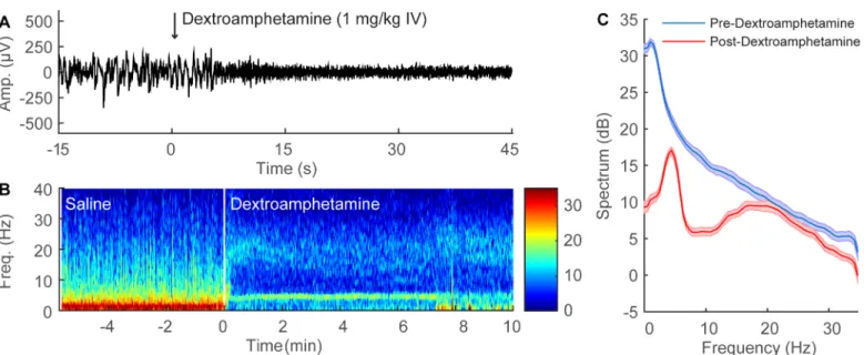 Fig 3C shows group power spectral density from all three rats during continuous sevoflur- sevoflur-ane sevoflur-anesthesia, computed from two-minute periods before (blue) and after (red) the  adminis-tration of dextroamphetamine (1 mg/kg IV)