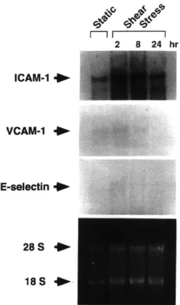 Figure  2.4.  Northern  blot  analysis  of  adhesion  molecule  induction  by shear  stress  in  HUVEC