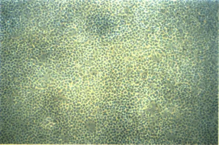 Figure 3.4.  E-selectin  is  not  induced  by  exposure  to  the  disturbed  flow  field.