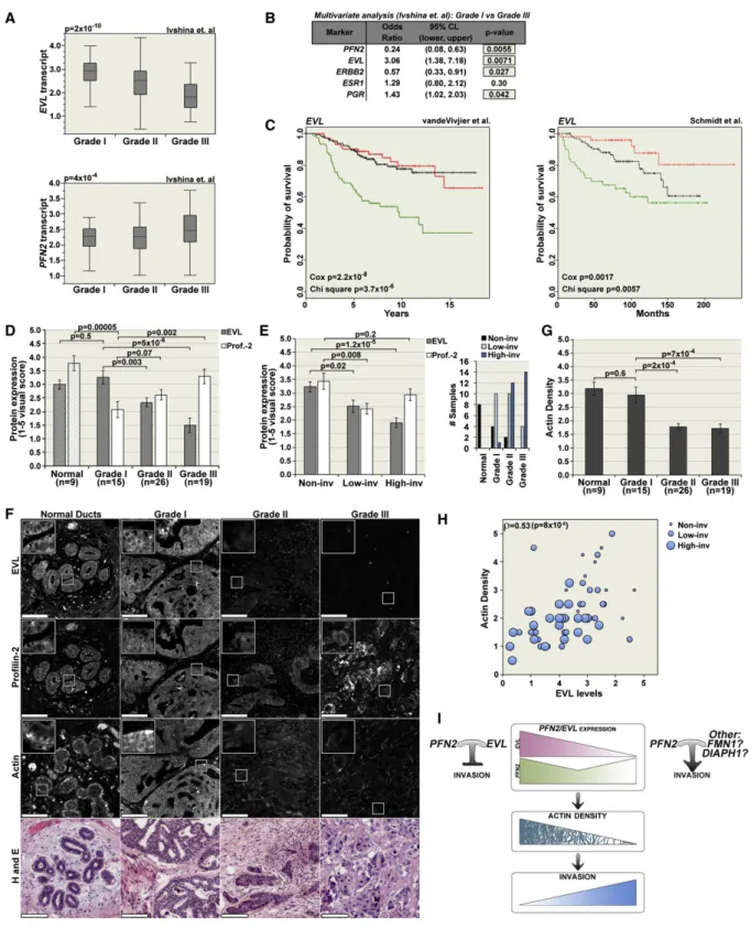 Figure 8. PFN2 and EVL Are Differentially Expressed in Human Breast Tumors