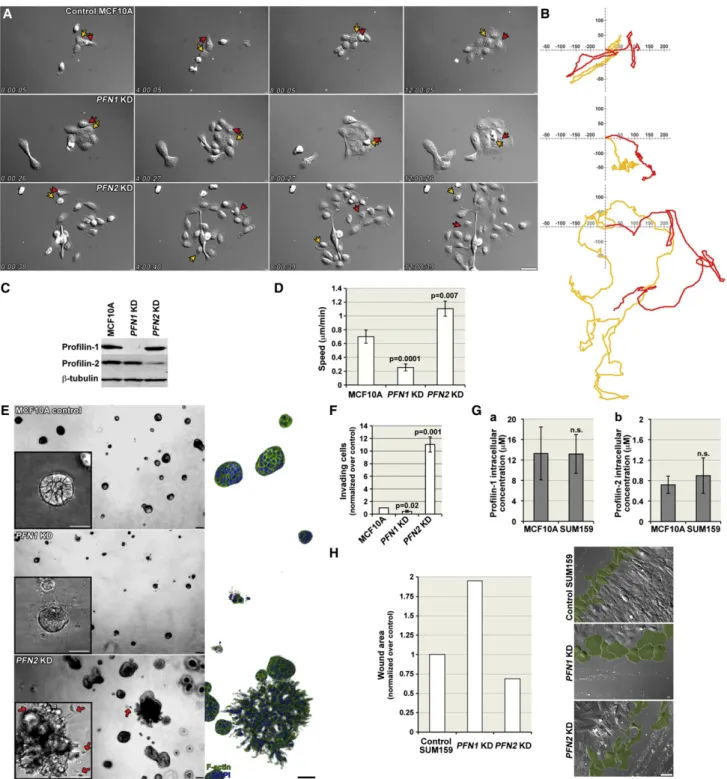 Figure 1. Profilin-1 and Profilin-2 Differentially Regulate Cell Migration and Invasion (A) Montages of DIC from Movie S1
