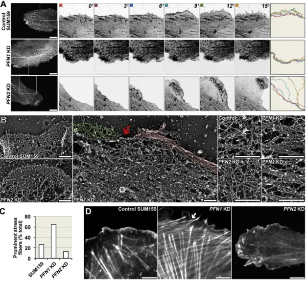 Figure 3. Profilin-2 Promotes Actin Bundling in SUM159 Cells
