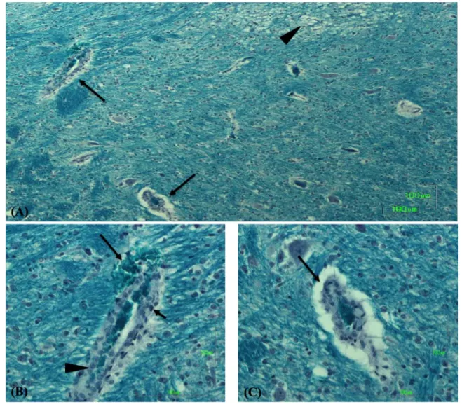 Figure 3.  Piglet challenged with positive control Sakai strain. (A) Section of the brain 815 