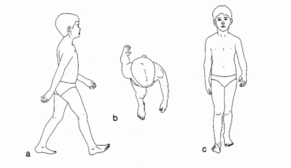 Fig. 2.4: Demarche vue dans les trois plans : a) sagittal, b) transversal, c) frontal ([VDO92]).