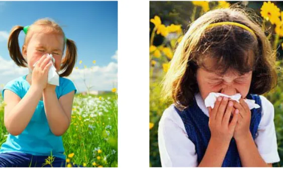 Figure 3 : La manifestation clinique la plus commune dans la rhinite allergique 