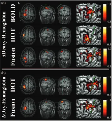 Fig. 5 Direct hemoglobin reconstructions from empirical data. This figure shows 共b兲 the model reconstructions using the DOT alone, BOLD alone, and 共 a 兲 fusion datasets for deoxy- and oxyhemoglobin changes