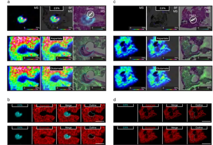 Figure 4. Local depletion of amino acids following inhibition of macropinocytosis in Kras G12D - -driven pancreatic tumors in vivo