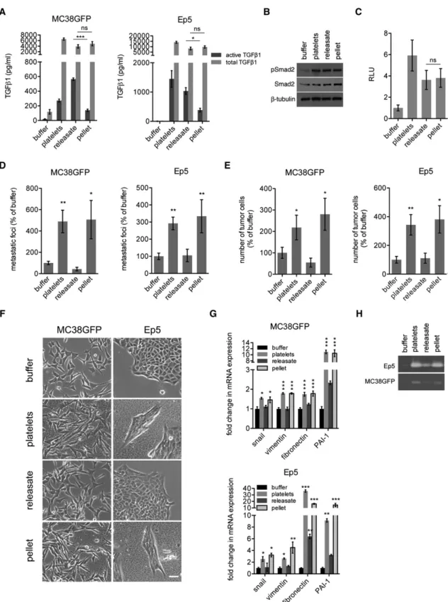 Figure 4. Platelet-Derived TGF b 1 and Platelet-Bound Factors Cooperate to Promote Metastasis