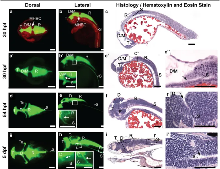 Fig. 2  Zebrafish brain ventricle anatomy at early and late larval stages. Using 2 nL rhomencephalic ventricular injections of fluorescein‑labeled  dextran and imaging by Selective Plane Illumination Microscopy (SPIM, or Lightsheet Microscopy), ventricular