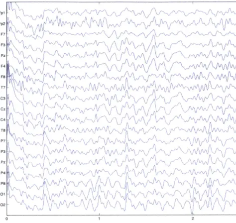 Figure  2-1:  Example  of  continuous  resting  scalp  EEG
