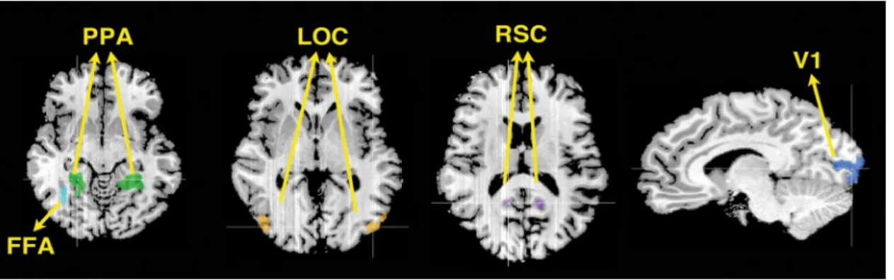Figure 2. Five regions of interests are shown on a representative participant’s brain