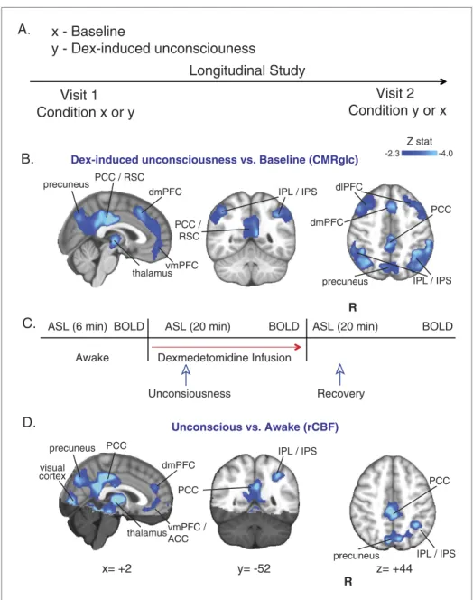 Figure 2. CMR glc  and rCBF are decreased in both the default mode and the frontal–parietal network brain regions  during unconsciousness