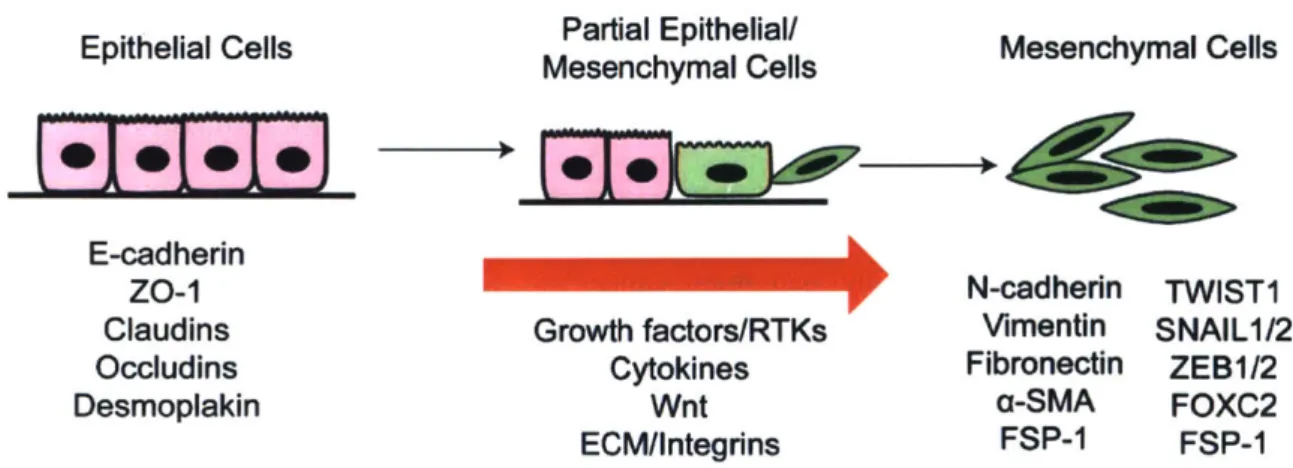 Figure  1.2  The  epithelial  to mesenchymal  transition  (EMT)  in  cancer progression