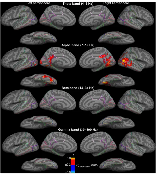 Figure 3. Comparisons of power changes of sustained oscillatory activity between auditory attention to phonetic vs