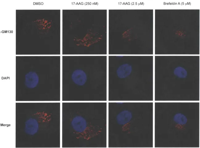 Figure  2.9:  Confocal  microscopy  analysis  of  Golgi  structure  with  17-AAG  treatment.