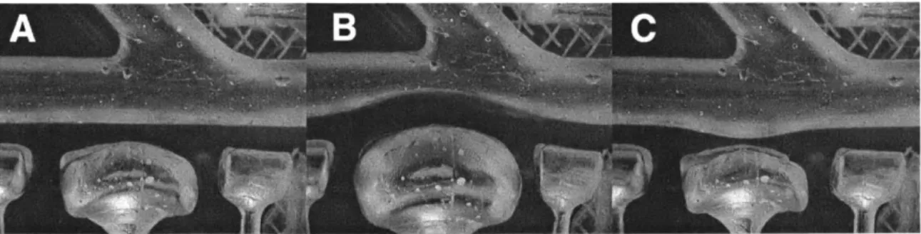 Figure  2-2:  Operation  of "push-pull  plungers".  (A)  Device  is  deflated  for normal geometry