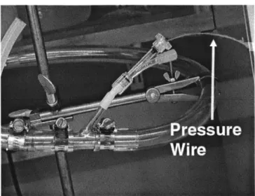 Figure 2-15:  Pressure  wire  insertion.