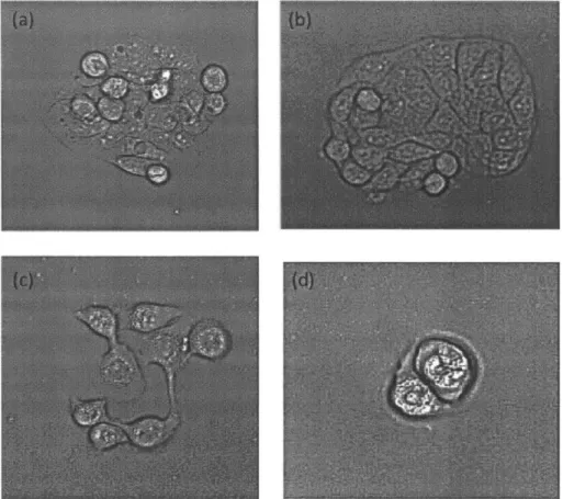 Figure  B-3:  Phase  contrast  microscopy  images  of  HT-29mes  reveals  continued  selec- selec-tive  killing  of  eukaryotes  in  culture