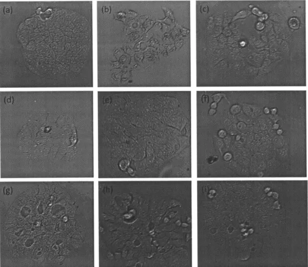 Figure  B-8:  Phase  contrast  microscopy  images  of  untreated  controls  (a),  333  puM treated  (b),  300  pM  treated  (c),  266  pM  treated  (d),  233  puM  treated  (e),  200  pM treated  (f),  166  pM  treated  (g),  133  pMlV  treated  (h),  and 