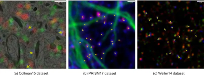 Fig 3. Results of DoGNet synapse detection on distinct datasets. Yellow arrows denote synapse orientation from presynaptic to postsynaptic sides.