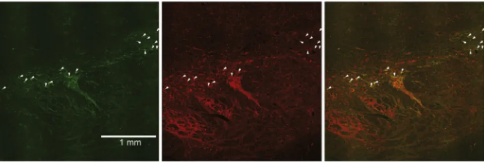 Figure S1. ChR2 Immunoreactivity followed the Irregular Outline of the TH-Positive Cell Bodies in the Monkey Midbrain, Related to Figure 2 Coronal sections through the midbrain show the spatial pattern of overlap between ChR2 immunoreactivity (green, left)