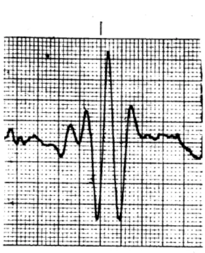 Figure  6.  Experimental  plots  of  Beam Intensity vs.  Frequency