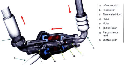 Figure 6 [17]. Components of HM II. HM II is a rotary pump that has a rotor that is rotated by the electromagnetic  forces generated by the motor.
