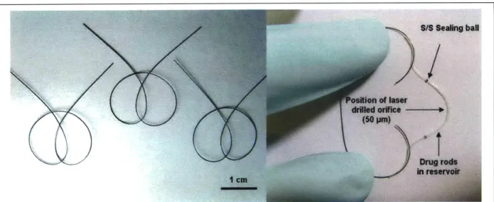 Figure  8.  Shaped  nitinol  wires  after heat treatment (left).  Drug  filled  silicone  tube  connected  with  a shaped nitinol wire (right)
