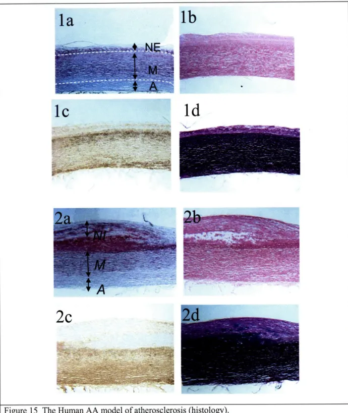 Figure  15  The  Human  AA  model  of atherosclerosis  (histology).