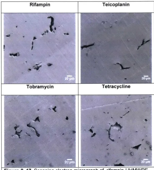 Figure  2.  17.  Scanning  electron  micrograph  of  rifampin-UHMWPE, gentamicin  sulfate-UHMWPE,  tetracycline HCI-UHMWPE,  fusidic acid-UHMWPE,  teicoplanin-UHMWPE,  ceftriaxone-UHMWPE, ciprofloxacin  HCI-UHMWPE,  and tobramycin-UHMWPE.