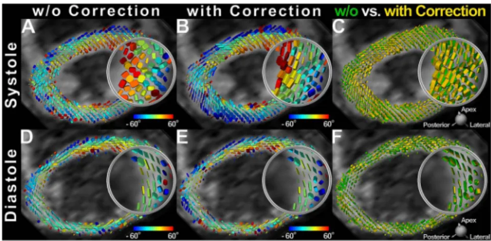Figure 5. Systolic and diastolic tensor maps with and without strain correction. Diffusion tensor fields acquired in systole (A,B) and diastole (C,D) are represented by superquadric glyphs and color-coded by the helix angle before and (A,C) after strain co