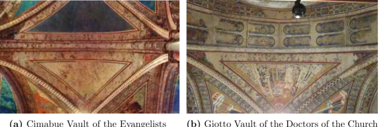 Figure 1.8 – Installation of SMADs at the Tympanum-Roof Interface [Basile, 2007]