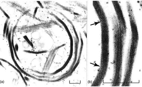 Figure  1-3:  Thin  section  of  the  coil:  Coils  were  purified  by  treating  the  Limulus sperm with  glycerol  and  Triton  X  100  along  with  several  centrifugation