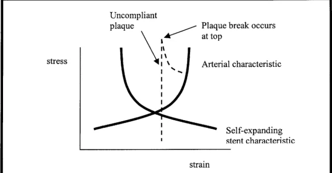 Figure  5  A  conceptual  representation  of  balloon  vs  self  expanding  stents.  The  left curve  shows  the  self-expanding  and  the  right the  arterial characteristic