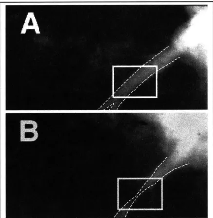 Figure  1.5:  Angiograms  showing  the  progression  of restenosis  in  a porcine  left  anterior  descending  (LAD)  coronary  artery  immediately after  stenting  (A)  and  3  months  post-operatively  (B)
