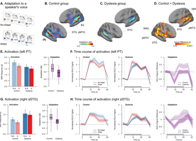 Figure 1. Reduced neural adaptation in dyslexia when listening to speech from a consistent voice  vs
