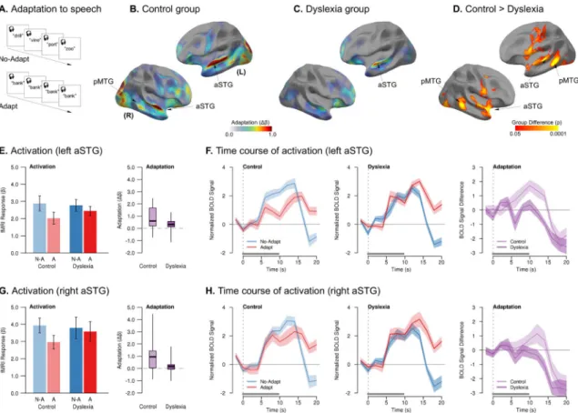 Figure 2. Reduced neural adaptation in dyslexia when listening to repeated speech