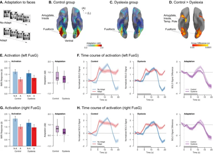Figure 5. Reduced neural adaptation in dyslexia when viewing repeated faces
