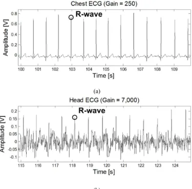 Fig.  2.  The  ensemble  head  BCG  from  64  beats  where  the  underlying  individual BCG waveforms are shown in gray