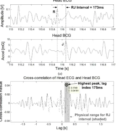 Fig. 6. Top: PPG taken from the mastoid region behind the left ear. Bottom: 