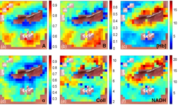 Fig. 2 Spectroscopy parameter maps acquired by quantitative spectroscopic imaging (QSI) overlaid on a white-light photograph of a cervix
