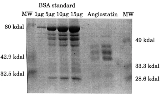 Figure  1:  Angiostatin  protein  analysis by coomassie blue  staining.