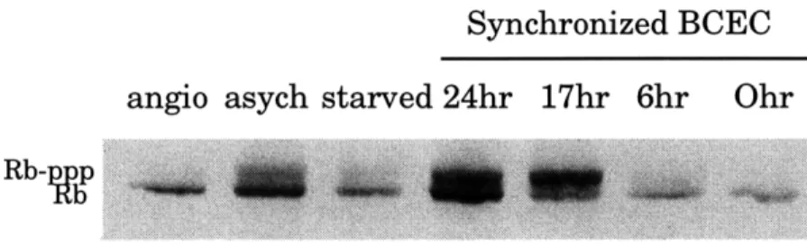 Figure  11:  The  effect  of angiostatin  on Rb  phosphorylation  in asynchonously growing  BCEC