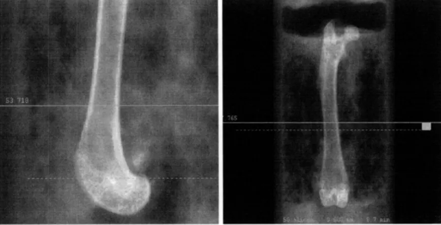 Figure 4. 2D  pCT  images showing  the regions of the femur that were  scanned and subsequently evaluated