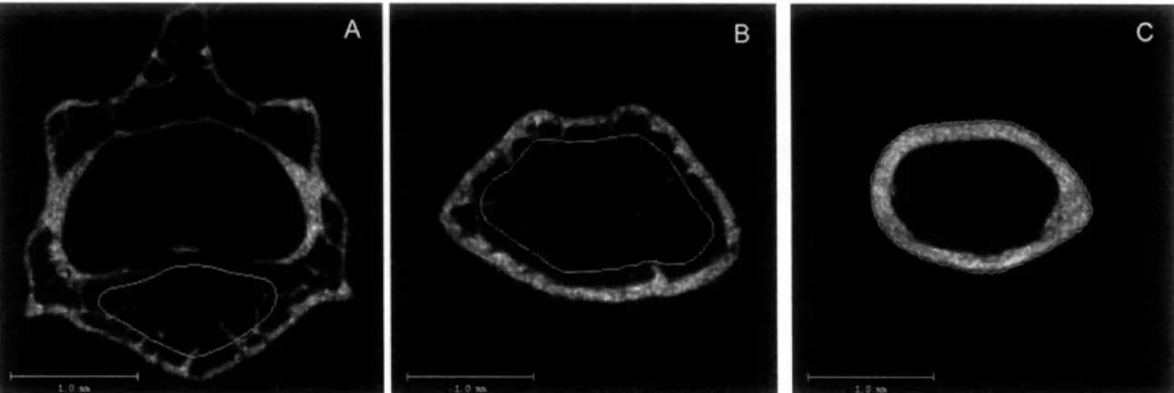 Figure  5. 2D  pCT images  showing  the regions  of trabecular bone  evaluation in the  L 5  vertebrae (A)  and  the distal femur  (B),  and the  region of  cortical bone evaluation  in the femoral  midshaft  (C).