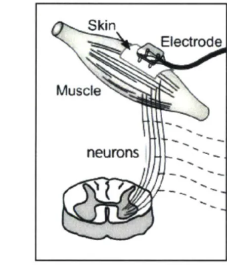 Figure  1-7:  Surface  electromyography  sensors  are  placed  upon  the  skin  over  muscles for  detection  of  activation  potential  (Image  credit:  Delsys)